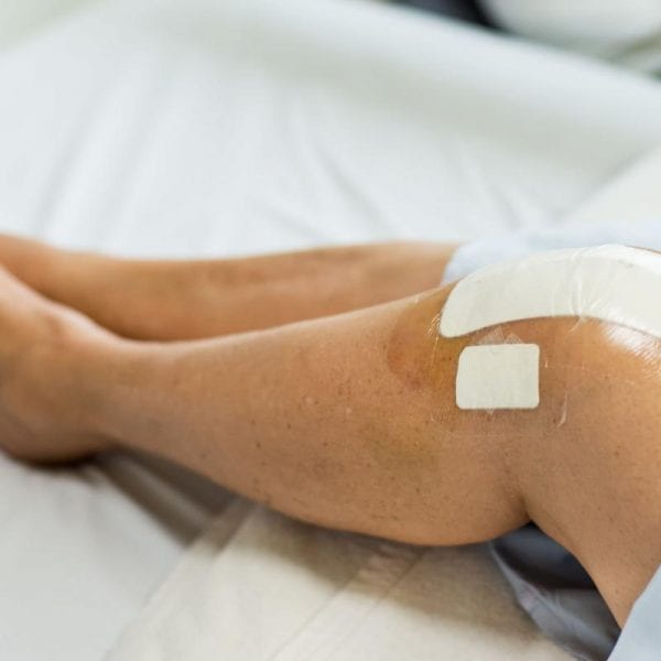 Nee Operative Pre Operative Therapy, Post Operative Therapy Nelson BC
